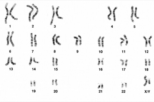 fig. normal human karyotype
