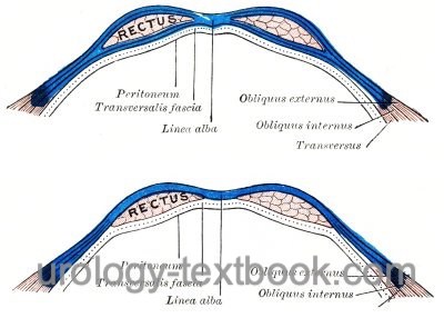 figure anatomy of the rectus sheath