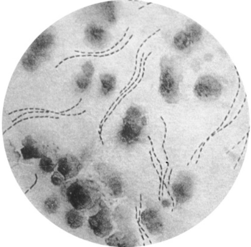 Microscopy of Haemophilus ducreyi, pathogen of chancroid