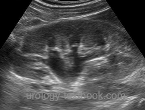 figure ultrasound examination of the ureter