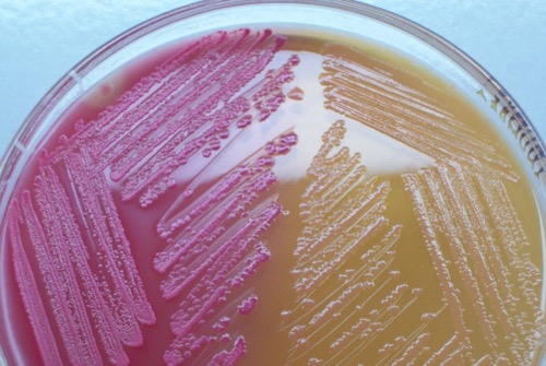 figure bacterial colonies on MacConkey agar