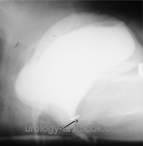 figure lateral voiding cystourethrography in female urinary incontinence